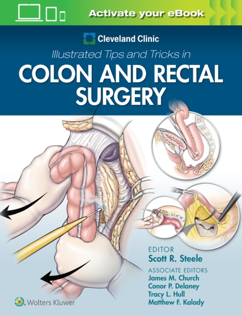 Cleveland Clinic Illustrated Tips and Tricks in Colon and Rectal Surgery, Paperback / softback Book
