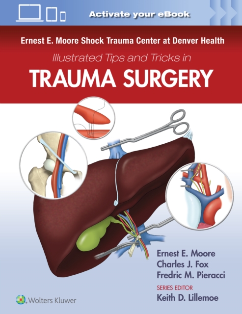 Ernest E. Moore Shock Trauma Center at Denver Health Illustrated Tips and Tricks in Trauma Surgery, Paperback / softback Book