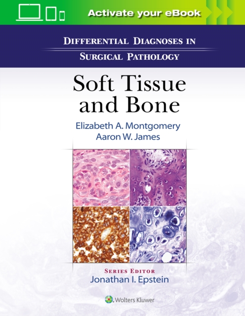 Differential Diagnoses in Surgical Pathology: Soft Tissue and Bone, Hardback Book