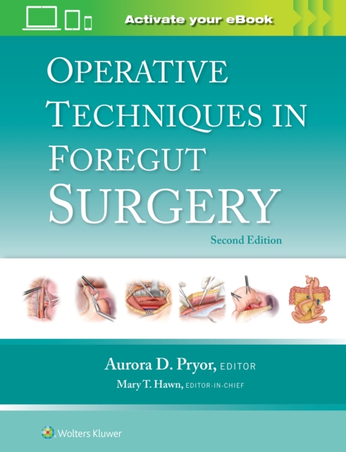 Operative Techniques in Foregut Surgery, Hardback Book