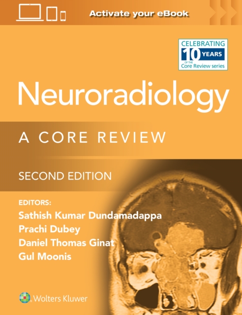 Neuroradiology : A Core Review, Paperback / softback Book