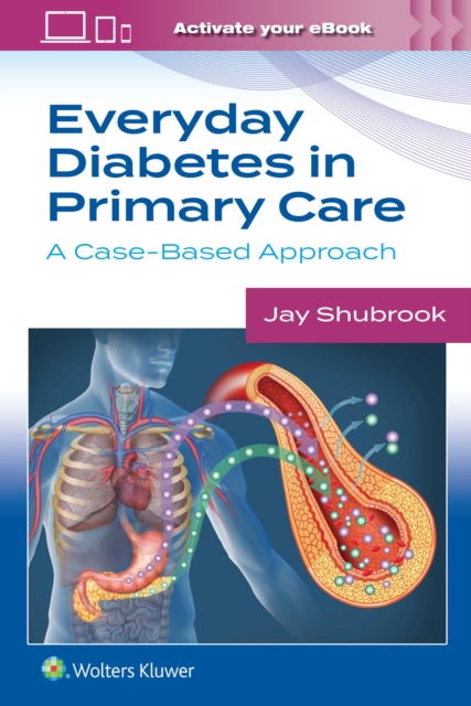 Everyday Diabetes in Primary Care : A Case-Based Approach, Paperback / softback Book