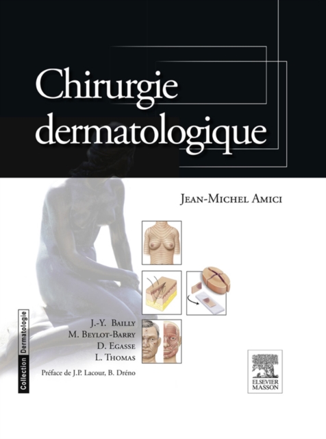 Chirurgie dermatologique, EPUB eBook