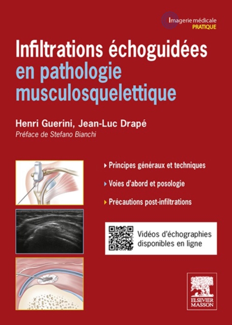Infiltrations echoguidees : en pathologie musculosquelettique, EPUB eBook