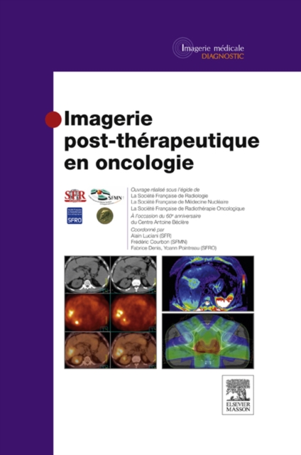 Imagerie post-therapeutique en oncologie, EPUB eBook