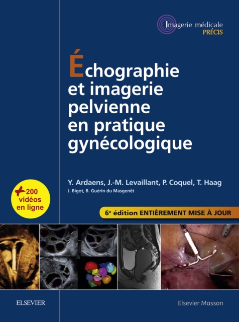 Echographie et imagerie pelvienne en pratique gynecologique, EPUB eBook