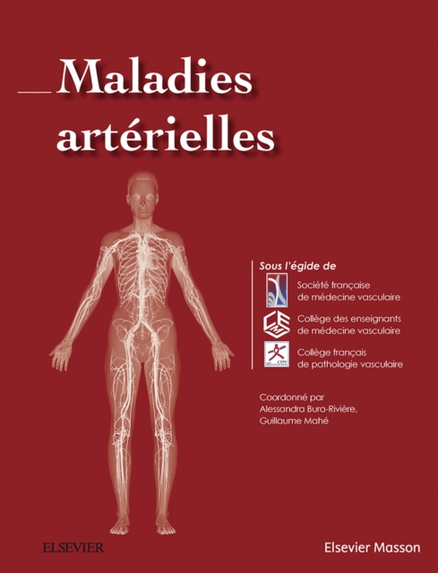 Maladies arterielles, EPUB eBook