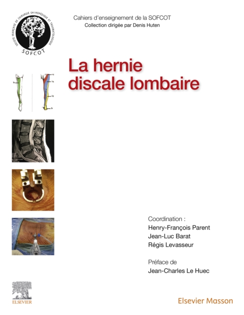 La hernie discale lombaire, EPUB eBook