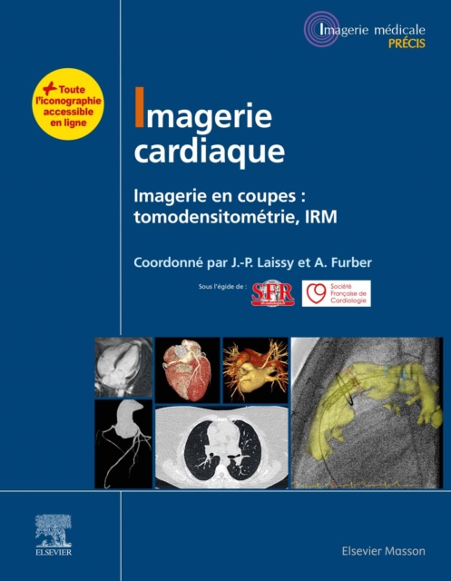 Imagerie cardiaque : Imagerie en coupes : scanner, IRM, EPUB eBook