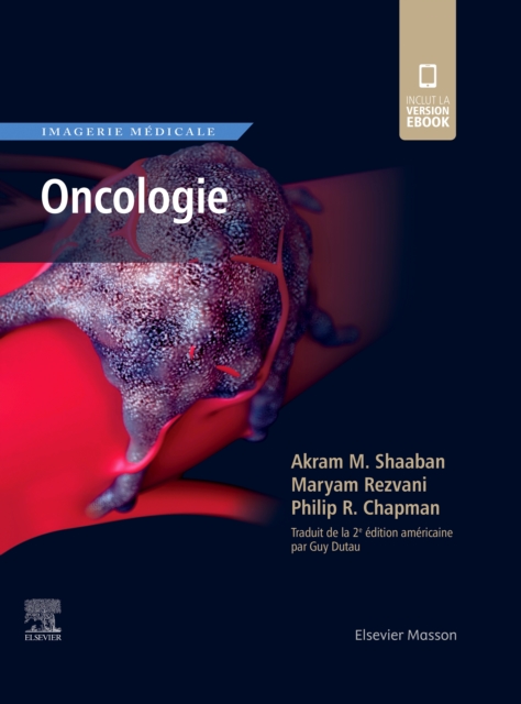 Imagerie medicale : Oncologie, PDF eBook