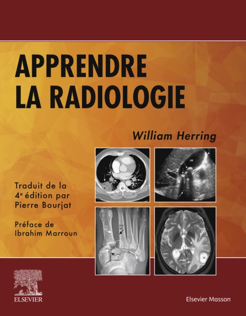 Apprendre la radiologie, EPUB eBook