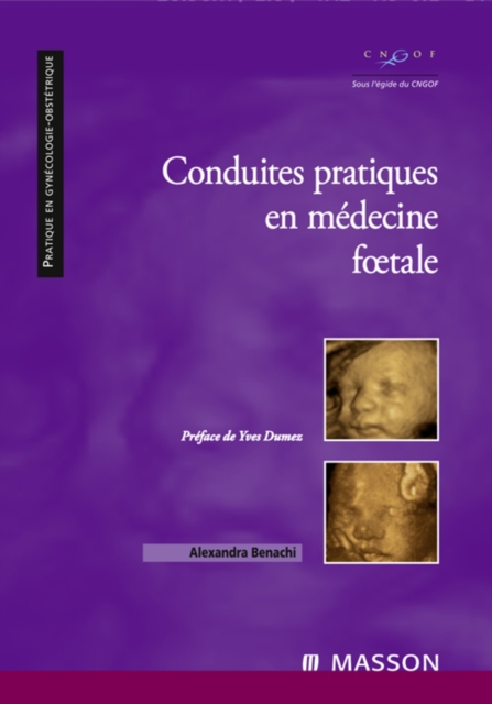 Conduites pratiques en medecine foetale, EPUB eBook