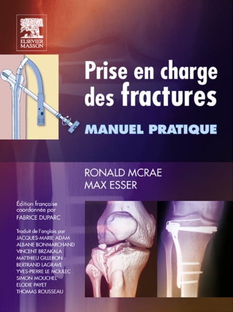 Prise en charge des fractures : Manuel pratique, EPUB eBook