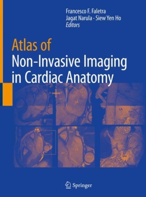 Atlas of Non-Invasive Imaging in Cardiac Anatomy, EPUB eBook