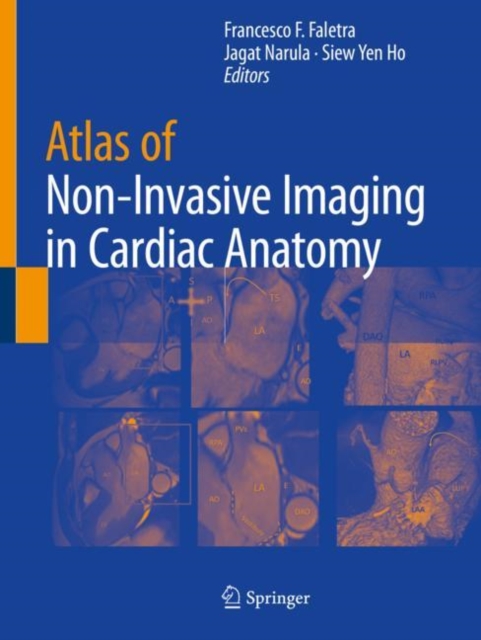Atlas of Non-Invasive Imaging in Cardiac Anatomy, Paperback / softback Book