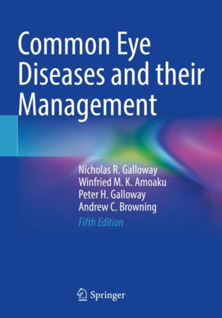 Common Eye Diseases and their Management, Paperback / softback Book