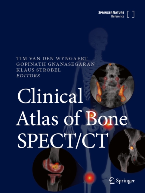 Clinical Atlas of Bone SPECT/CT, EPUB eBook