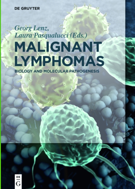 Malignant Lymphomas : Biology and Molecular Pathogenesis, EPUB eBook