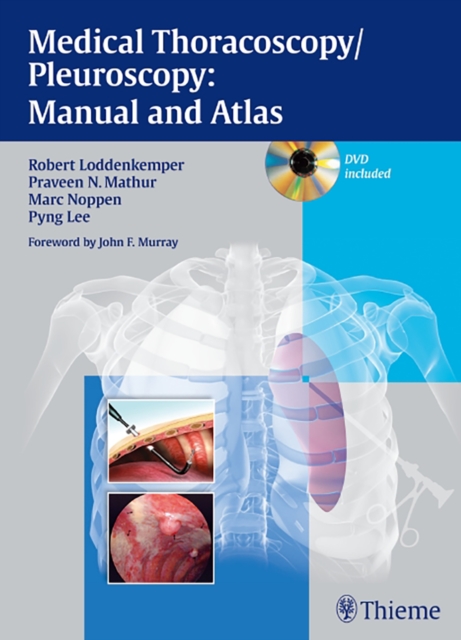 Medical Thoracoscopy / Pleuroscopy: Manual and Atlas, Hardback Book