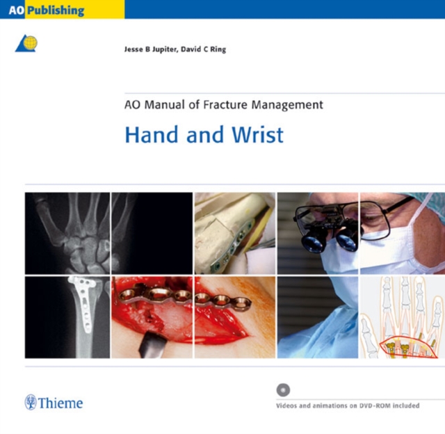 AO Manual of Fracture Management - Hand and Wrist, Hardback Book