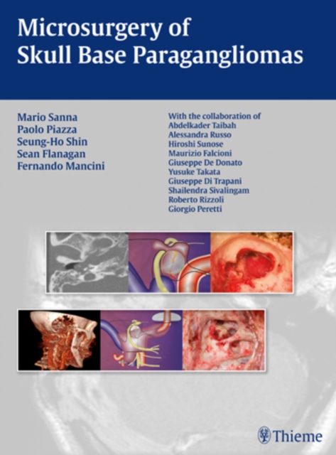 Microsurgery of Skull Base Paragangliomas, Hardback Book
