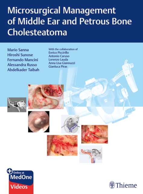 Microsurgical Management of Middle Ear and Petrous Bone Cholesteatoma, Multiple-component retail product, part(s) enclose Book