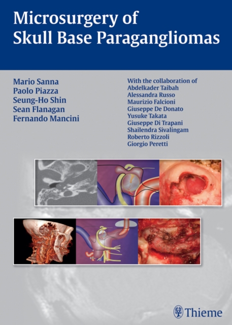 Microsurgery of Skull Base Paragangliomas, EPUB eBook