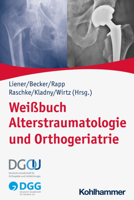 Weibuch Alterstraumatologie und Orthogeriatrie, EPUB eBook