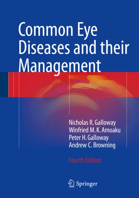 Common Eye Diseases and their Management, PDF eBook
