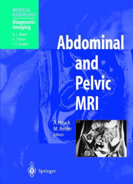 Abdominal and Pelvic MRI, Paperback Book