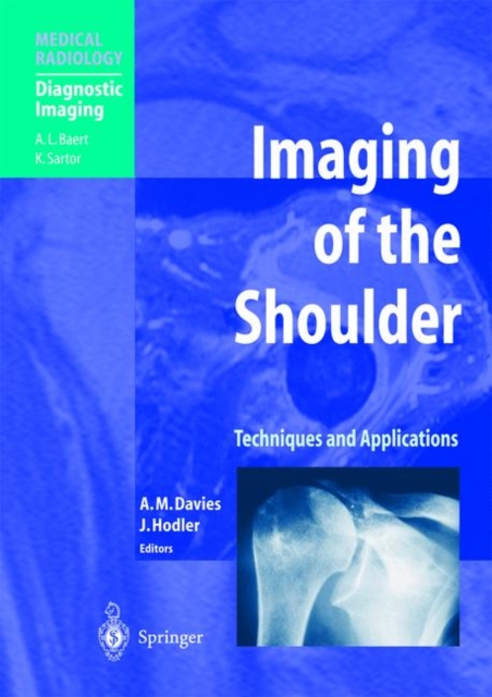 Imaging of the Shoulder : Techniques and Applications, Hardback Book