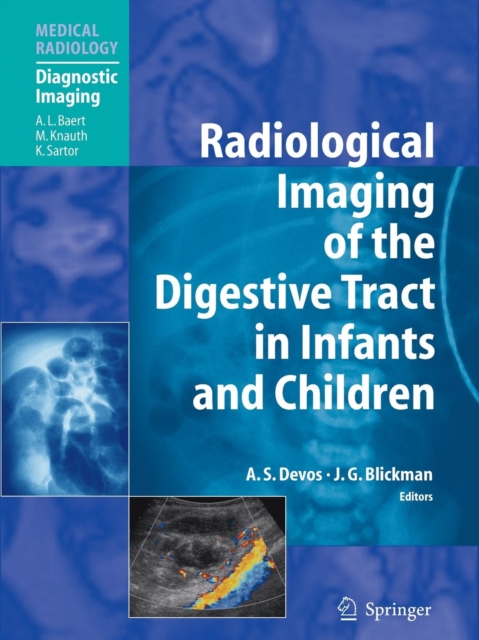 Radiological Imaging of the Digestive Tract in Infants and Children, Paperback Book