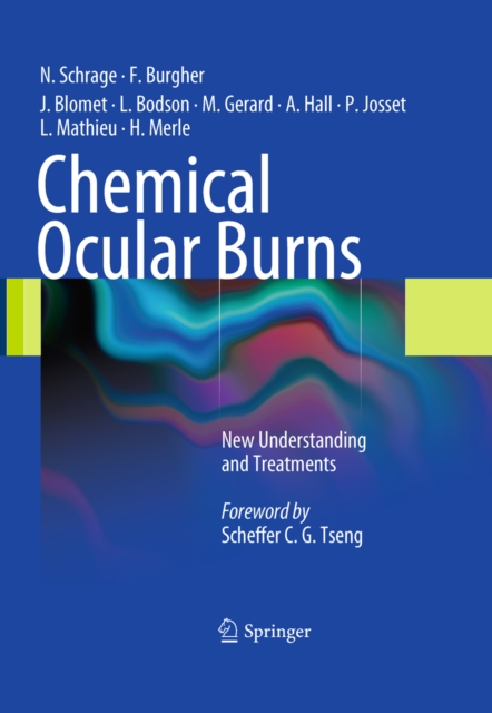 Chemical Ocular Burns : New Understanding and Treatments, PDF eBook