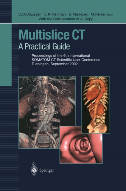 Multislice CT : A Practical Guide Proceedings of the 6th International SOMATOM CT Scientific User Conference Tuebingen, September 2002, PDF eBook