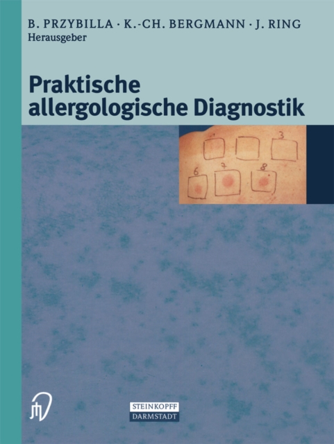 Praktische Allergologische Diagnostik, PDF eBook