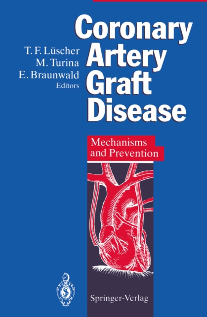 Coronary Artery Graft Disease : Mechanisms and Prevention, PDF eBook