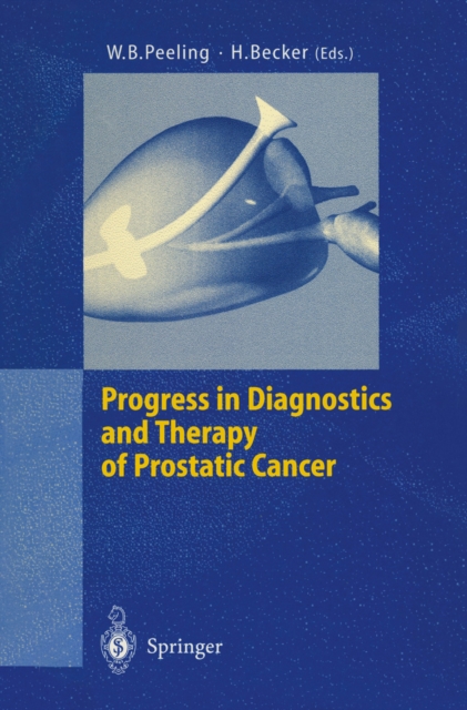 Progress in Diagnostics and Therapy of Prostatic Cancer, PDF eBook