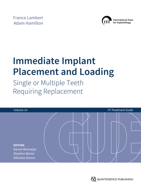 Immediate Implant Placement and Loading - Single or Multiple Teeth Requiring Replacement, EPUB eBook