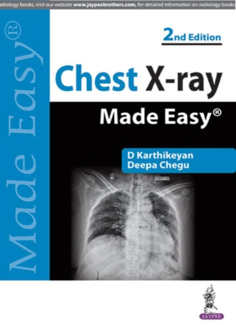Chest X-ray Made Easy, Paperback / softback Book