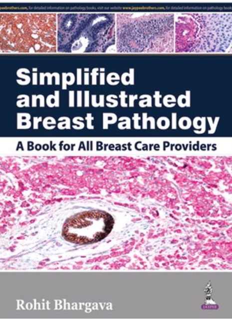 Simplified and Illustrated Breast Pathology, Hardback Book