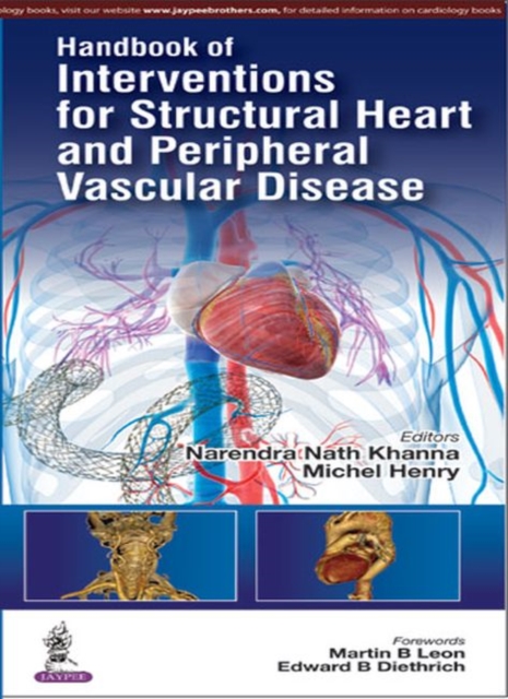 Handbook of Interventions for Structural Heart and Peripheral Vascular Disease, Paperback / softback Book