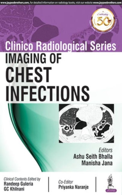 Clinico Radiological Series: Imaging of Chest Infections, Paperback / softback Book