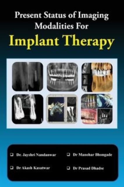 Present Status of Imaging Modalities for Implant Therapy, Paperback / softback Book