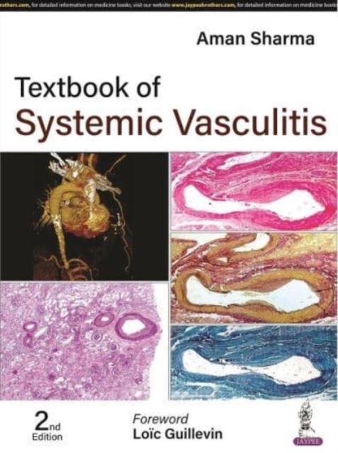 Textbook of Systemic Vasculitis, Hardback Book