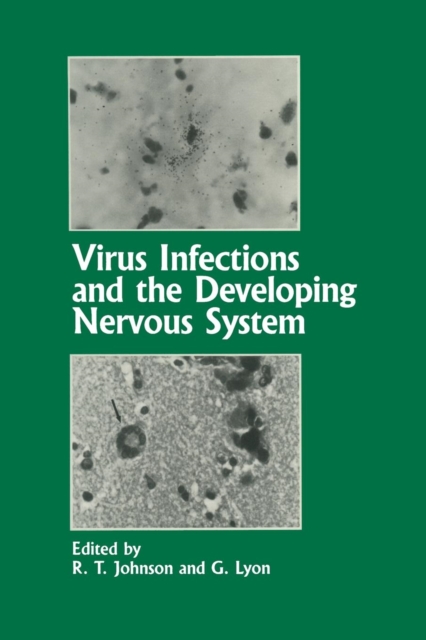 Virus Infections and the Developing Nervous System, Paperback / softback Book