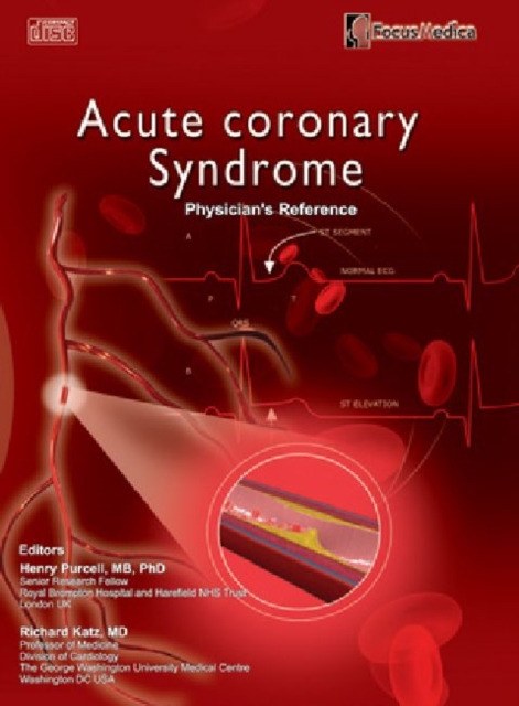 Acute Coronary Syndrome : Physician's Reference, CD-ROM Book