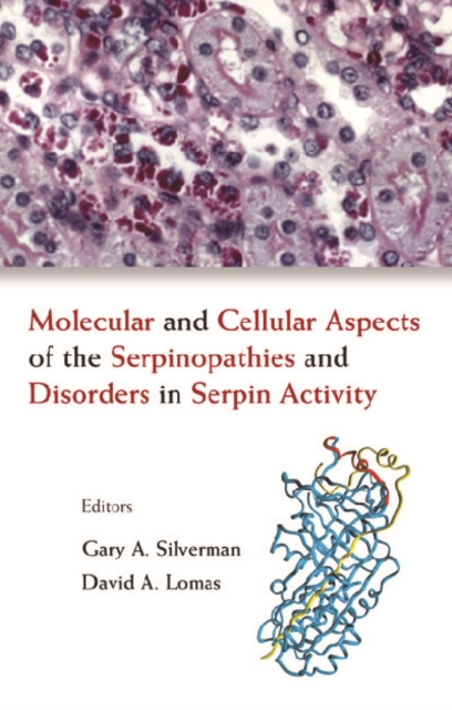 Molecular And Cellular Aspects Of The Serpinopathies And Disorders In Serpin Activity, PDF eBook