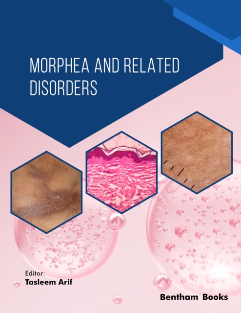 Morphea and Related Disorders, EPUB eBook