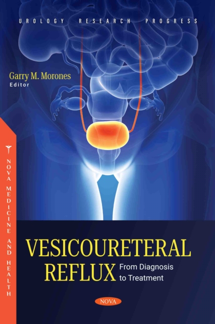 Vesicoureteral Reflux: From Diagnosis to Treatment, PDF eBook