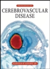 Principles of Cerebrovascular Disease - Book